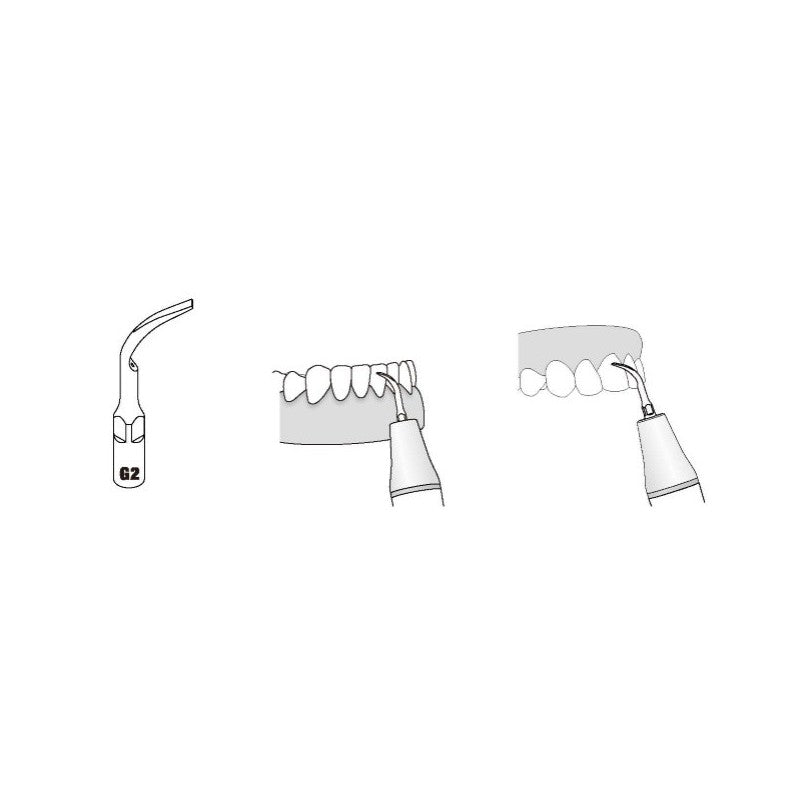 Insert GD2 compatible Satelec  ultrarésistant UR - WOODPECKER - ootopfti.com