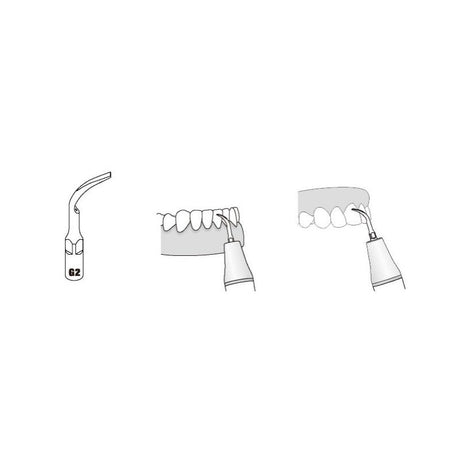 Insert GD2 compatible Satelec  ultrarésistant UR - WOODPECKER - ootopfti.com