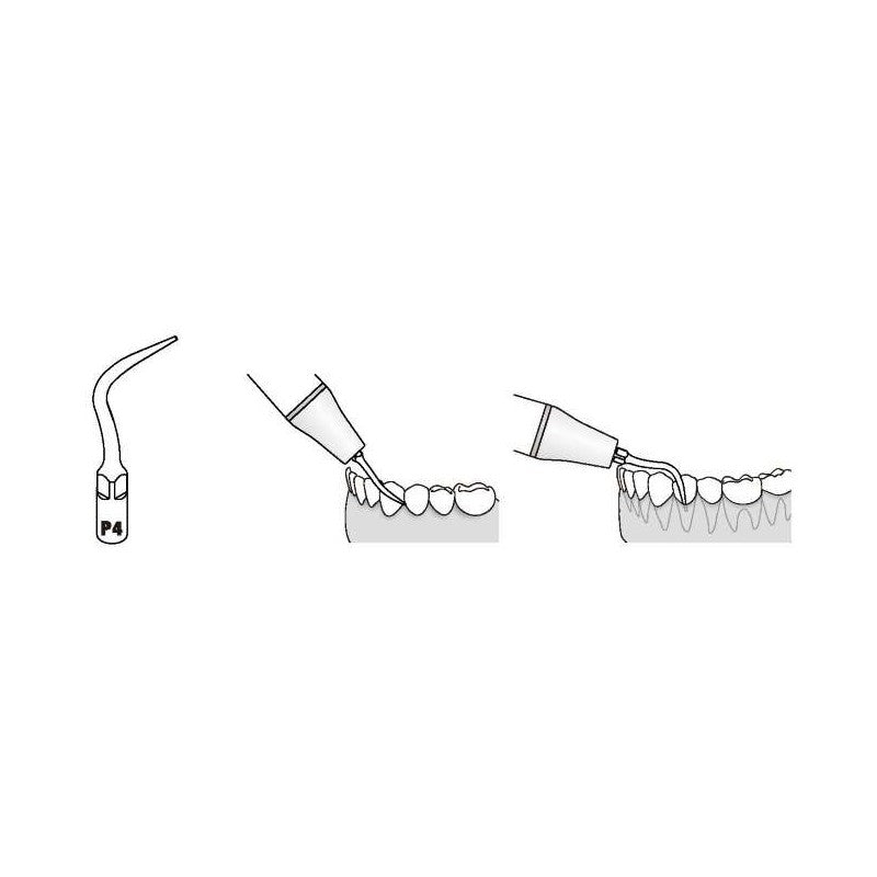 Insert PD4 compatible Satelec - WOODPECKER - ootopfti.com